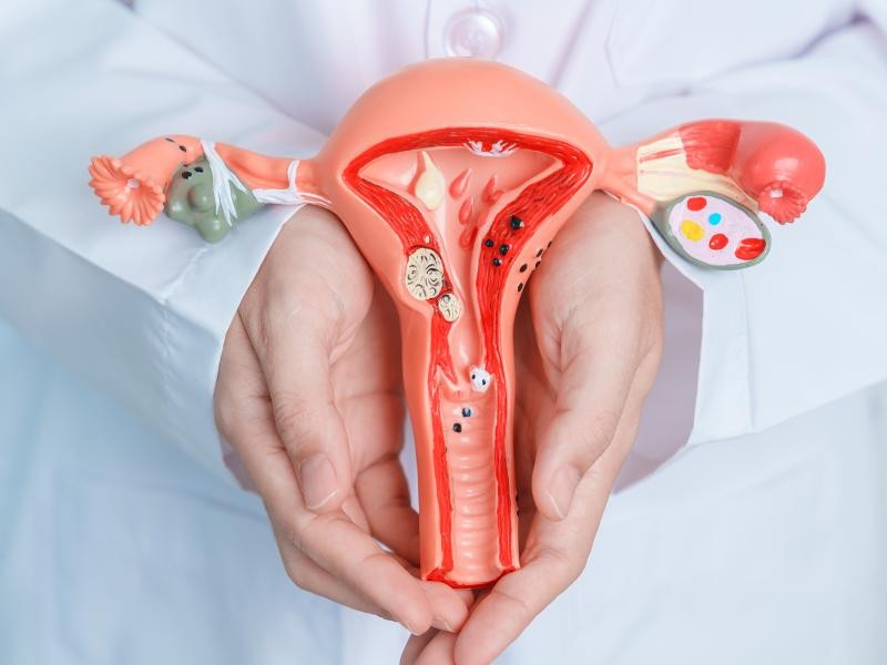 Cirurgia Histerectomia Robótica